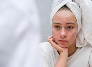 Aká je správna starostlivosť o mastnú pleť?